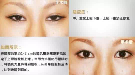 眼睛无神怎么办 眼睛无神 眼睛无神怎么办？