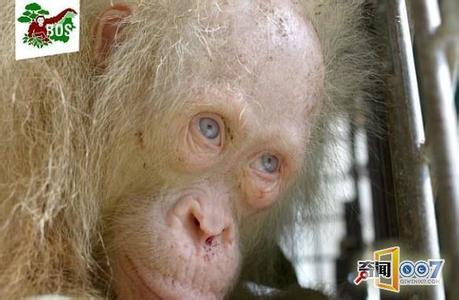 全身毛发脱落是什么病 这里不长毛发是什么病