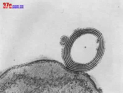 非特异性结肠炎 不传秘方： 慢性非特异性结肠炎两年一月断根白花蛇舌汤