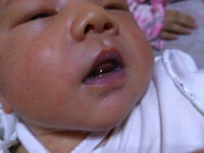 游泳嘴唇发紫 小孩游泳嘴唇发紫是怎么回事？