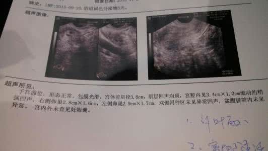 同房导致孕囊流产 孕囊下移怎么办？持续下移可能导致流产