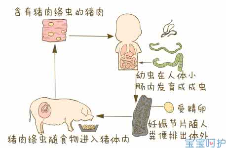 蛔虫病症状判断方法 蛔虫病症状判断方法 简单一招，教你判断宝宝是不是得了蛔虫病！