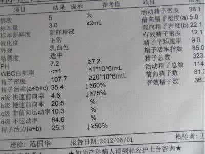 精子活力多少是正常 精子活力多少正常 正常精子活力是多少呢