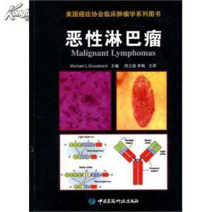 b细胞淋巴瘤是癌症吗 沉默的癌症 “沉默的癌症”淋巴瘤的６大警讯