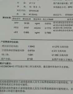 绒毛穿刺多久出结果 绒毛穿刺多久有结果