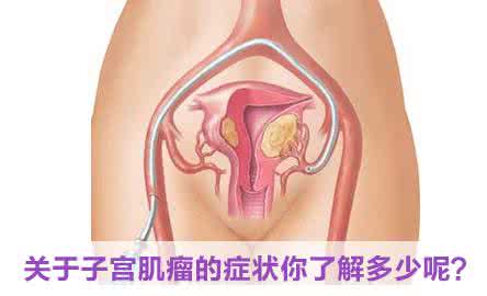 子宫肌瘤的症状表现 子宫肌瘤的症状表现 子宫肌瘤的表现症状有哪些