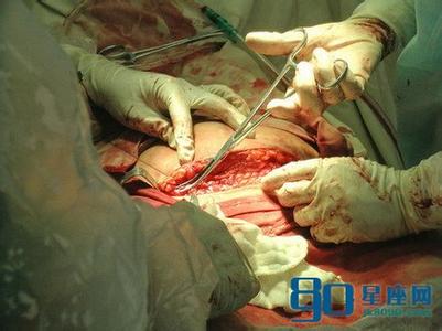 刨妇产和顺产哪个好 刨妇产 女人生孩子，顺产好还是剖腹产好？