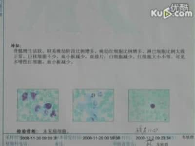 血脂检验 检验血脂，您做对了吗？