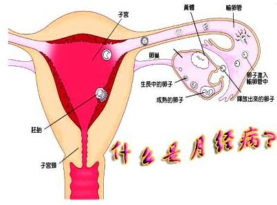 一个月月经来了三次 大姨妈一个月来三次是怎么回事