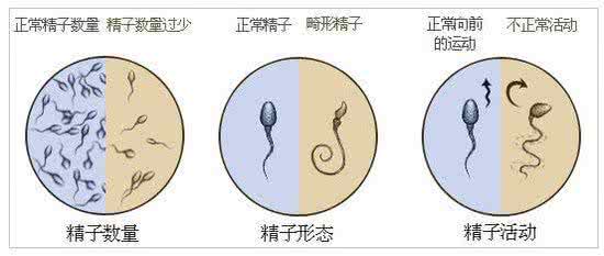 男性结扎后能不能射精 男性不能射精的原因是什么