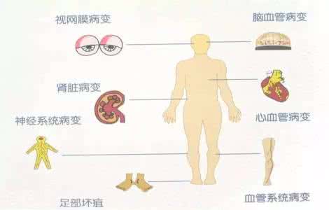 糖尿病芯片 糖尿病防止进入“芯”时代