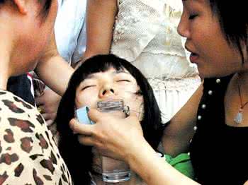 癫痫病能治好吗 治疗癫痫病的方法有哪些