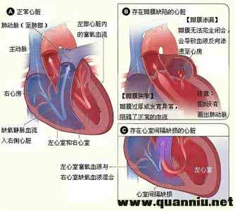 心脏杂音有什么危害 心脏杂音原因 心脏杂音有什么危害 心脏杂音的原因与危害