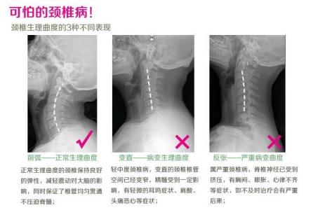 缓解颈椎疼痛的动作 怎样缓解颈椎疼痛 舒缓颈椎痛的有效方法