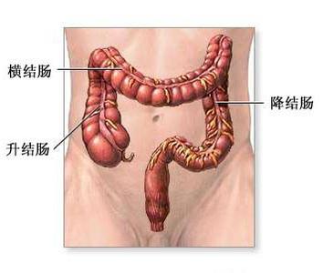 结肠炎怎么治疗 结肠炎怎么治 这样治疗结肠炎比较好