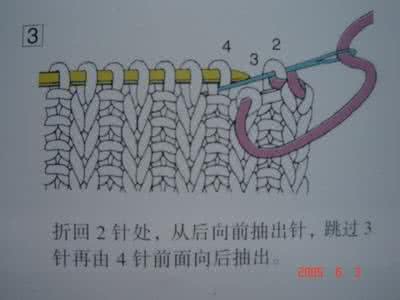 双罗纹收针法视频 引用 罗纹针收针法 2