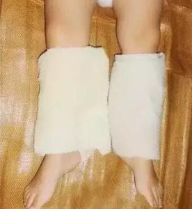湿毛巾绑腿退烧法 湿毛巾绑在身体这处奇迹发生了