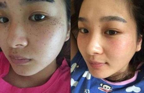 五旬大妈假扮空姐诈骗 55岁大妈假扮29 土豆加上“它”，6天祛斑，55岁大妈一个月逆龄20