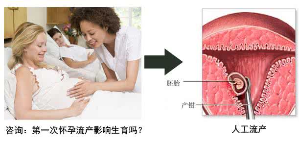 刮宫影响生育吗 打胎会影响生育吗?