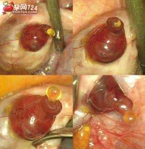 精子能活多久 卵子排出后能存活多久