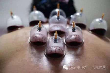 体内的洪荒之力 拔罐,叫醒你体内的“洪荒之力”