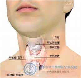 甲状腺肿大症状 甲状腺肿大症状 甲状腺肿大如何预防