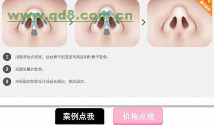 硅胶假体隆鼻多少钱 杨明勇 硅胶假体隆鼻多少钱