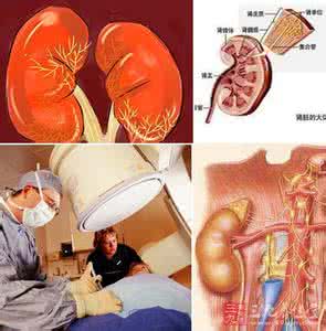 导致肾衰竭的原因 肾衰竭治疗 导致肾衰竭的原因有哪些