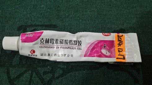 治疗痤疮的消炎药 治疗痤疮的消炎药有哪些
