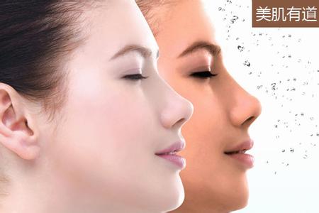 下巴祛痘 下巴痘成活火山 四个祛痘妙招你必知