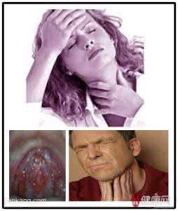 逃之夭夭 慢性咽炎 快乐,让老姐的慢性咽炎逃之夭夭