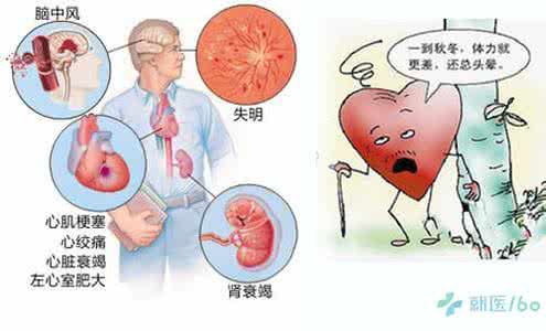 高血压并发症 高血压并发症 高血压最怕四种并发症！两种食物化解病根儿