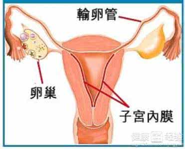 子宫内膜异位症不孕 子宫内膜异位症怎么治 子宫内膜异位症引起不孕