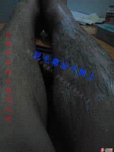 女孩子下面痒用什么药 女孩子下面痒是怎么回事呢？