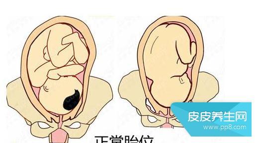 导致胎位不正的原因 胎位不正是什么原因 导致胎位不正的原因有哪些呢?