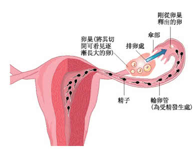滴虫性阴道炎的病因 滴虫性阴道炎的3个病因