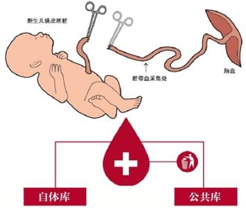 存脐带血一年多少钱 存脐带血有用吗