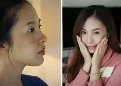 老中医孙女张雅茹照片 老中医孙女张雅茹 老中医给孙女祖传祛斑妙招,5年的斑点就用30天
