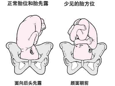 什么时候检查胎位 胎位检查要注意什么