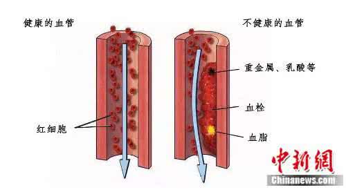 保持年轻的心态 4大“血管清道夫” 保持血管“年轻态”