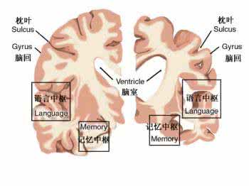 脑萎缩的临床表现 脑萎缩的临床表现有哪些？