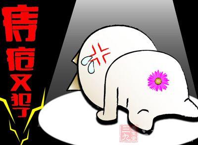 醋酸氟轻松软膏治痔疮 痔疮治疗 这样做让你轻松摆脱痔疮烦恼