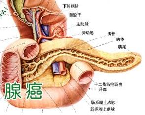 胰腺癌的早期症状 胰腺癌的早期症状 正确了解胰腺癌