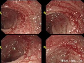 大便粘滞不爽爱放屁 大便粘滞不爽爱放屁 屁不放不爽 可怎么放屁才不被人知道呢