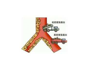 高密度脂蛋白的作用 高密度脂蛋白 高密度脂蛋白的基本功能