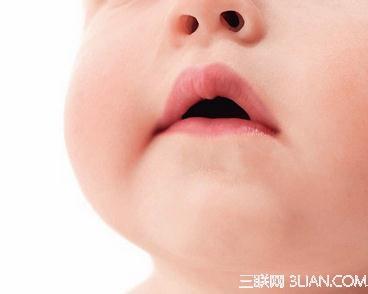 婴儿兔唇的原因 “兔唇”儿产生的5大原因