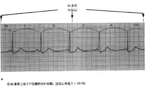 怎样从头开始学英语 心电图从头开始学