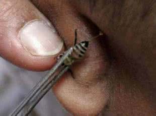 针灸为什么能治病 为什么说性爱能治病?