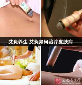 艾灸治疗皮肤病的方法 艾灸治疗皮肤病 皮肤病更适宜用艾灸来防治！