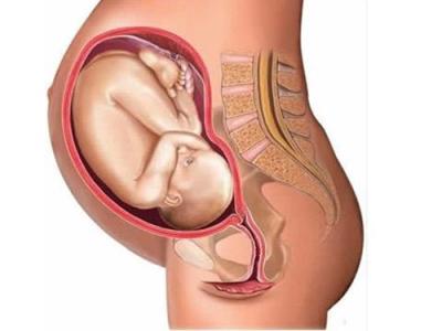 胎儿宫内生长受限 胎儿宫内生长受限 胎儿宫内生长受限应该怎么办？